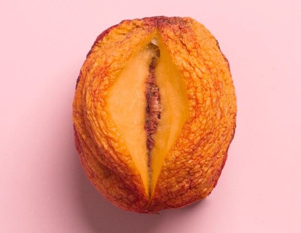 การผ่าตัดเลเบียแบบใบมีดแผลเล็กเหมาะกับใคร?