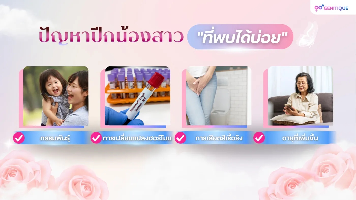 ปัญหาปีกน้องสาวที่พบได้บ่อย